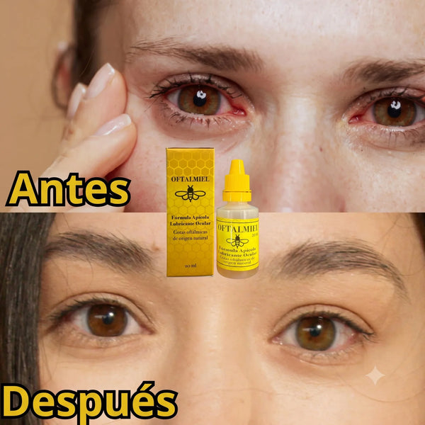 Kit de Gotas de Miel Apícola para los Ojos