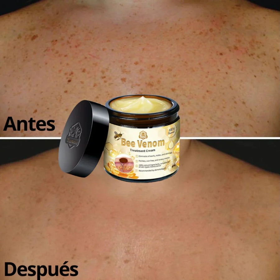 Crema de Veneno de Abejas