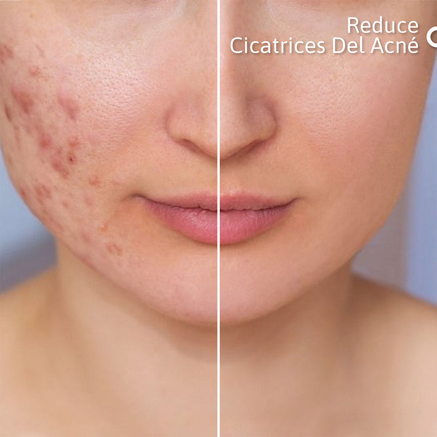 Sérum Facial Niacid (Niacinamida)